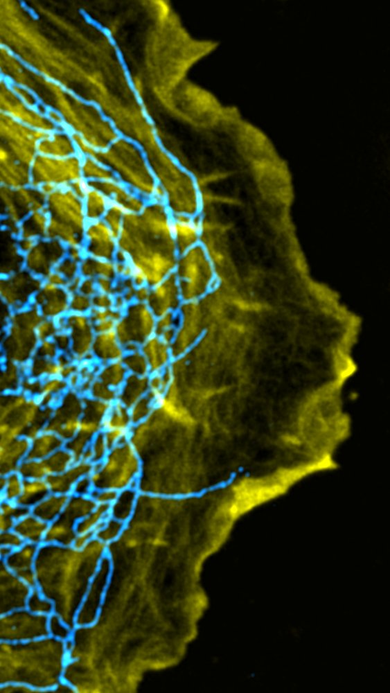 Pablo J. Sáez / now posts in a better place (BSky) (@pj_saez) on Twitter photo Leading edge of a moving #cell observed under the microscope.
Just because we love #cellmigration, it's #FluorescenceFriday and soon will be holidays.
<a href="/cellcommlab/">CellComM Lab</a> #scicomm #Microscopy <a href="/focalplane_jcs/">FocalPlane</a> Leading edge of a moving #cell observed under the microscope.
Just because we love #cellmigration, it's #FluorescenceFriday and soon will be holidays.
<a href="/cellcommlab/">CellComM Lab</a> #scicomm #Microscopy <a href="/focalplane_jcs/">FocalPlane</a>