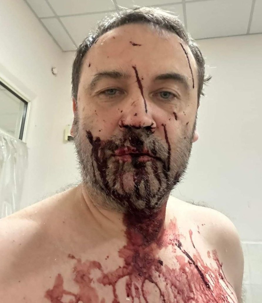 galluzzilucio's tweet photo. 2/La sua casa è stata presa di mira da un #drone russo a arrivato a #Kiev.
❗️Ponomarev è il leader politico della #Legione della #Libertàrussa.
#russiamerda https://t.co/15vjY4EJ9N