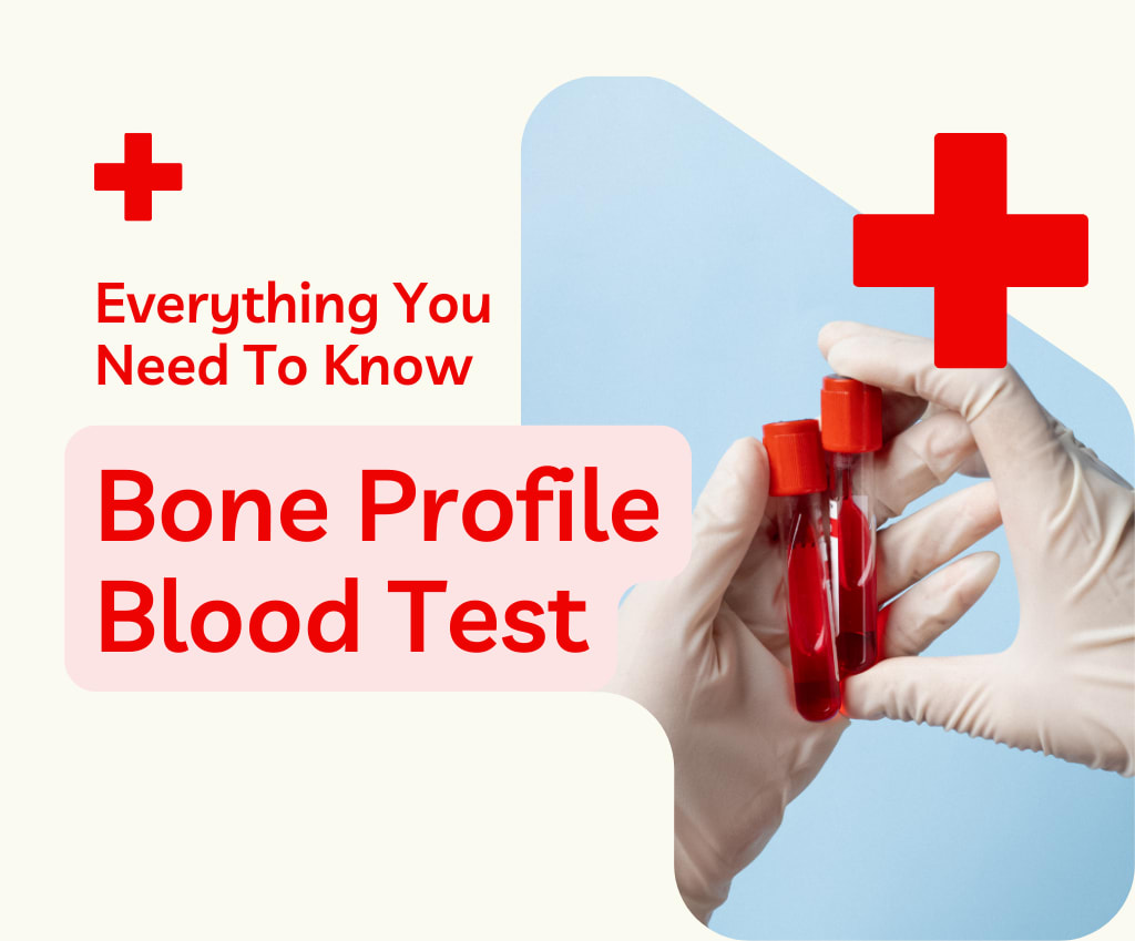 LisaBrown2016's tweet photo. 🩺 Want to know more about the Bone Profile Blood Test? 🦴✨ Check out this detailed guide on its importance, procedure, and results. Take charge of your health!

Read more: https://t.co/KHCpqrfdbX

#BoneHealth #BloodTest #HealthAwareness https://t.co/dl93wbAylW