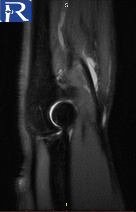 MSK Radiologist, MD tweet media