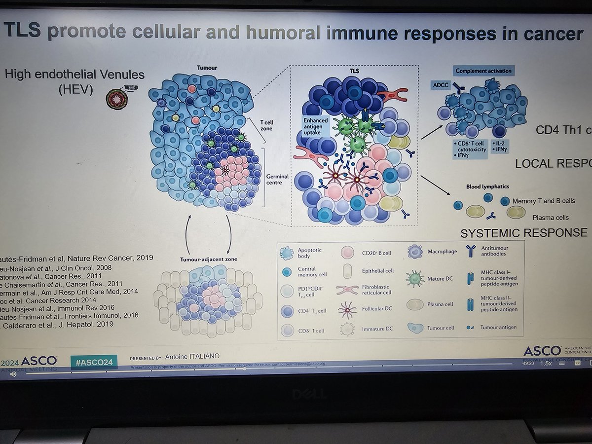 peush_me's tweet image. Tertiary Lymphoid structure(TLS) constituting B and T lymphocytes are emerging as biomarker in sarcomas which are going to be immunoresponsive also drugs like reforafenib (also tried strategy in CRC) are being used  with IO to make tumor hot Presneted by Antoine ITALIANO ASCO2024