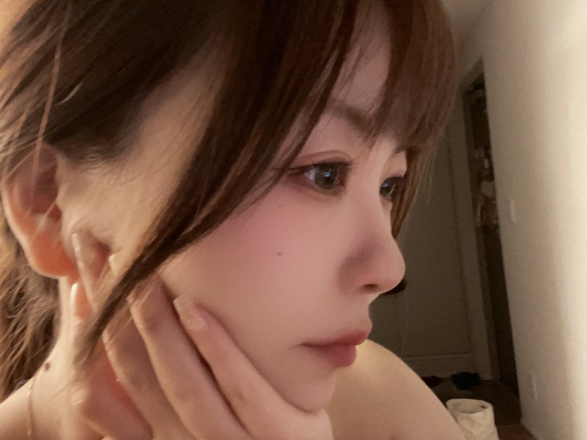 goblinslayer76's tweet image. 整牙3年半了，还有一年，麻了