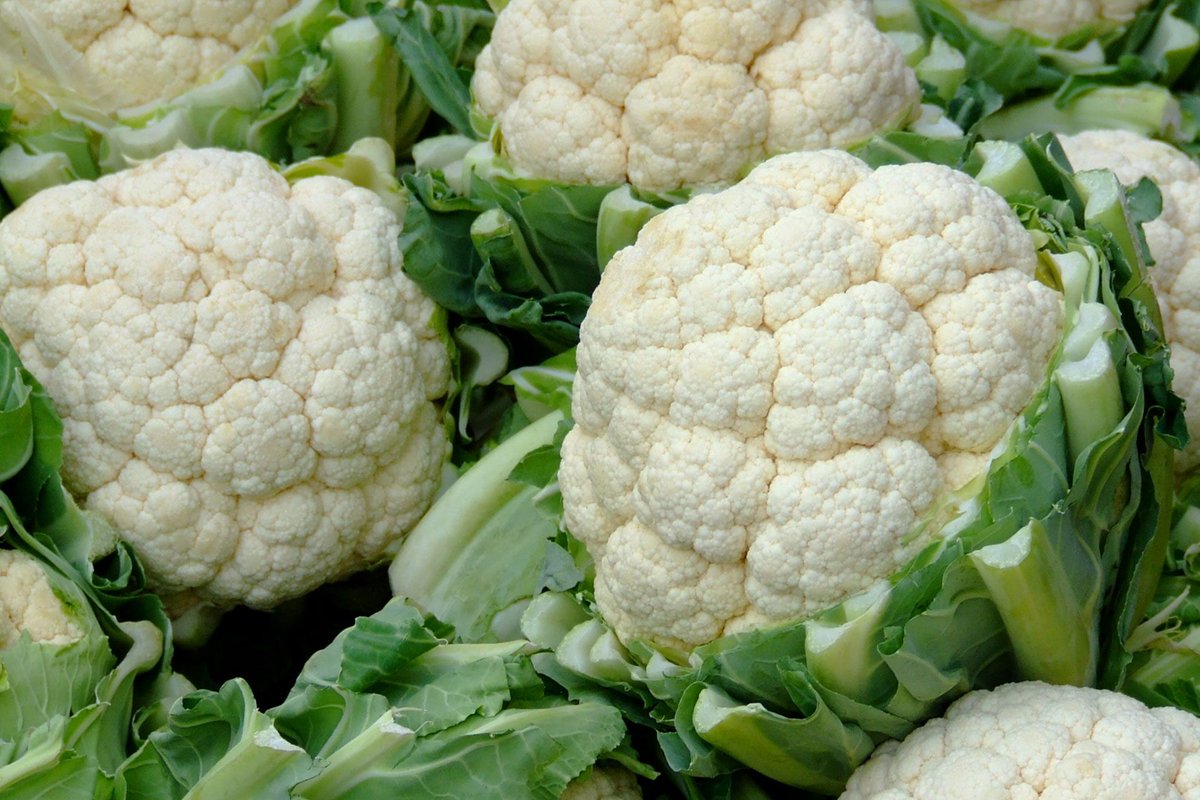 Membranoproliferative GN (MPGN) = "you double the membrane" - Dr. Glen Markowitz #BRCU2024

Large glomerular, lobular, cauliflower like