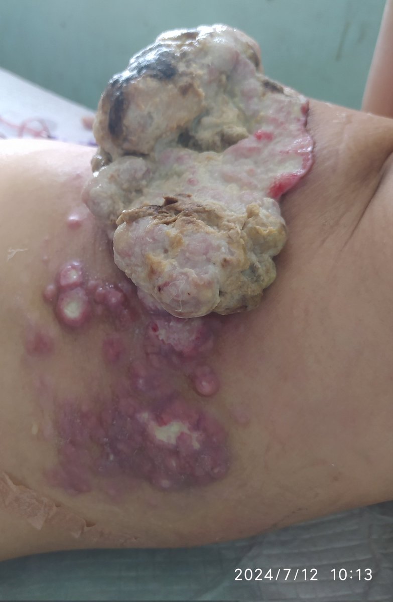 decofiestasyari's tweet image. 🆘🆘 Ángeles, ya no sé cómo pedir #Ayuda Por favor, por piedad, faltan 
$ 300 para hacerme tomografías y Gammagrama. Estoy en la más extrema pobreza, no tengo nada que vender, hasta la nevera se me dañó. Sola no puedo. 0102 04249014646 10302119 paypal.me/yaritza70 GRACIAS