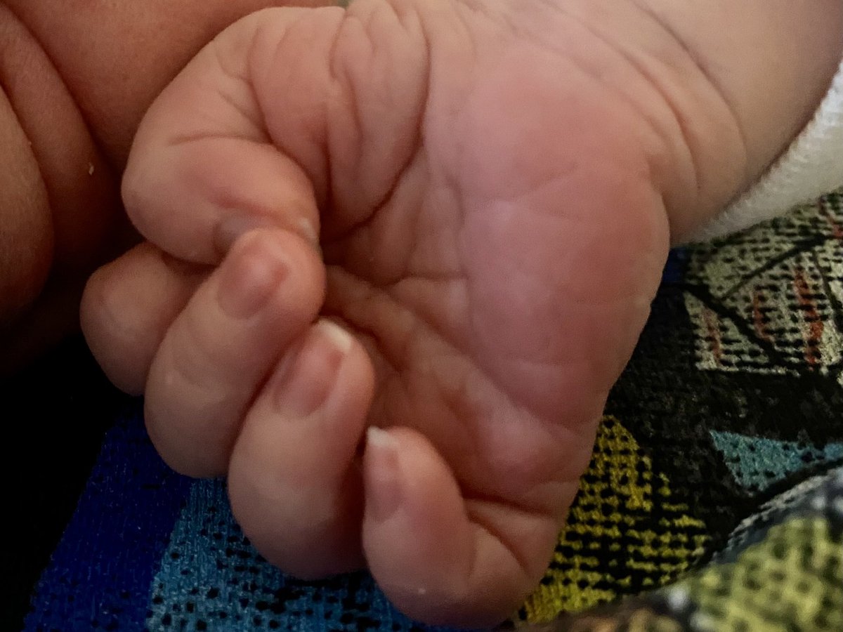 @zecalvin.bsky.social tweet media