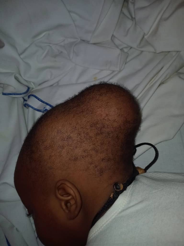 TRES TRES URGENT ⛔⛔⛔⛔

URGENCE⛔😭 , CET ENFANT DOIT SUBIR UNE OPERATION , VOS DONS SUR👇
772874564 wave et OM.