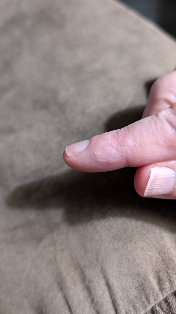 fluffytdow's tweet photo. Meal prep shenanigans......with my 89 year old grandpa not being able to keep out of my way while cooking I got a bit of boiling hot pasta water on my finger. Meals are prepped for work though....even if I got a couple of blisters. Made the family some chicken and rice too. https://t.co/BIiO2ulISK