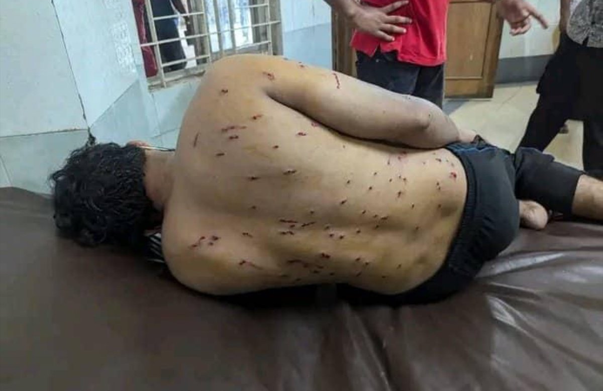 imranislamiman's tweet photo. @sajeebwazed Brave voices in Bangladesh are being silenced by violence and oppression. The government has blocked the internet worldwide to hide everything.
#AllEyesonBangladesh
#SaveBangladeshiStudents
#StepDownHasina
#HumanRightsViolation https://t.co/xbJ4pPBvsy