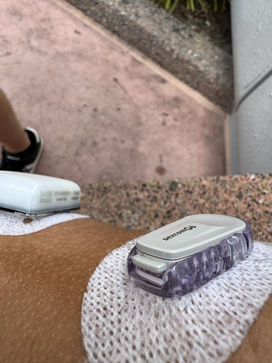 Yoel_M's tweet photo. @dexcom_medical every time I’m in the sun my Dexcom breaks in the same way. https://t.co/eUDX12jiR0