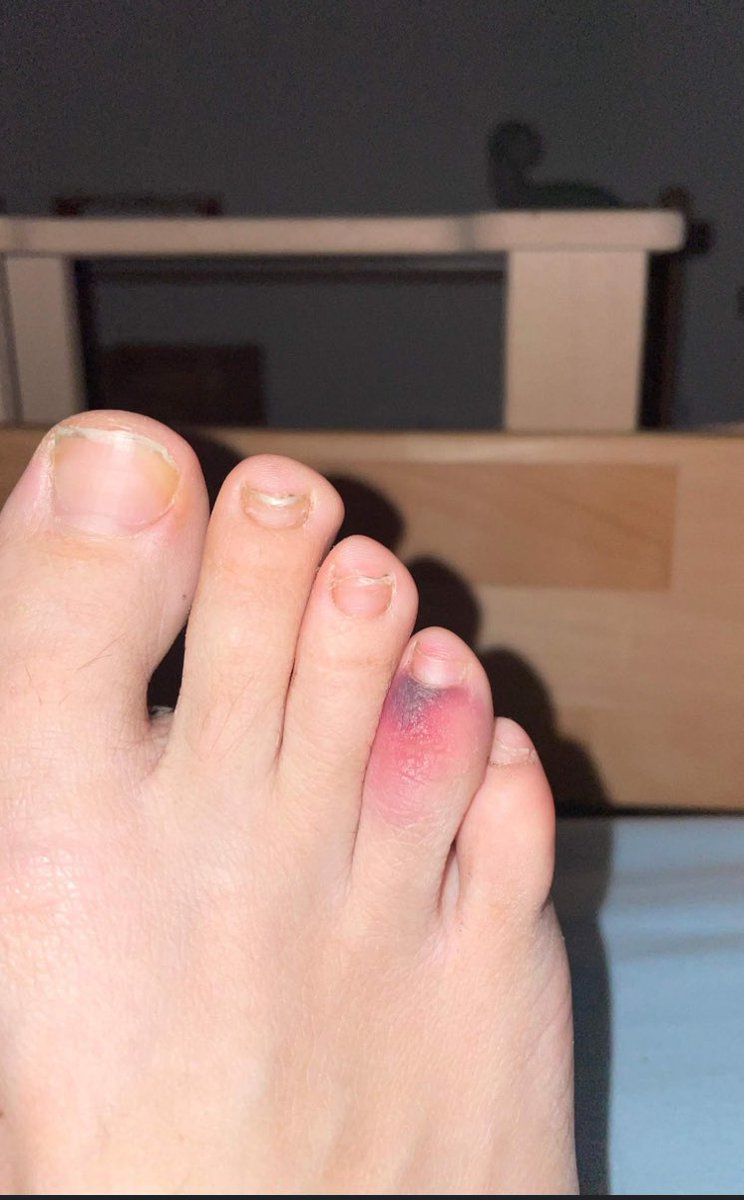 Exklusiv Bilder des ficker von Domes zeh:
#RammelHSV