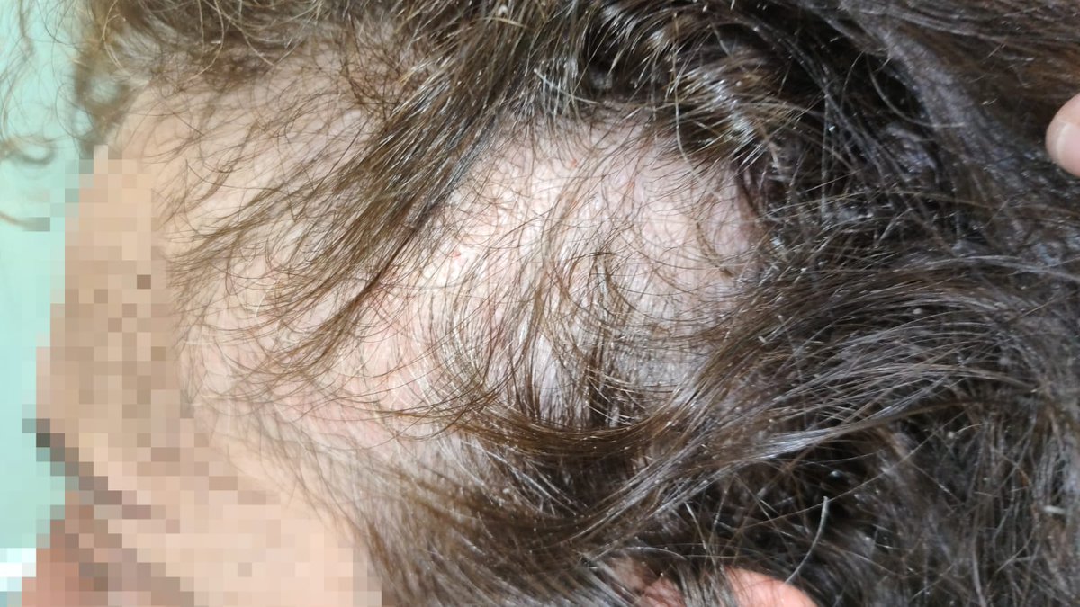 CoordAcaipCat's tweet photo. Hoy en MAS ENRIC, una interna ha intentado asfixiar a una funcionaria , hemos de dar gracias a que se rompiera el cordón utilizado. Todo por indicar a la interna que se han de cumplir las normas de convivencia básicas. Dimisiones ya #QueremosVolverVivosACasa #TotsSomNuria https://t.co/3UAgaQv8fD