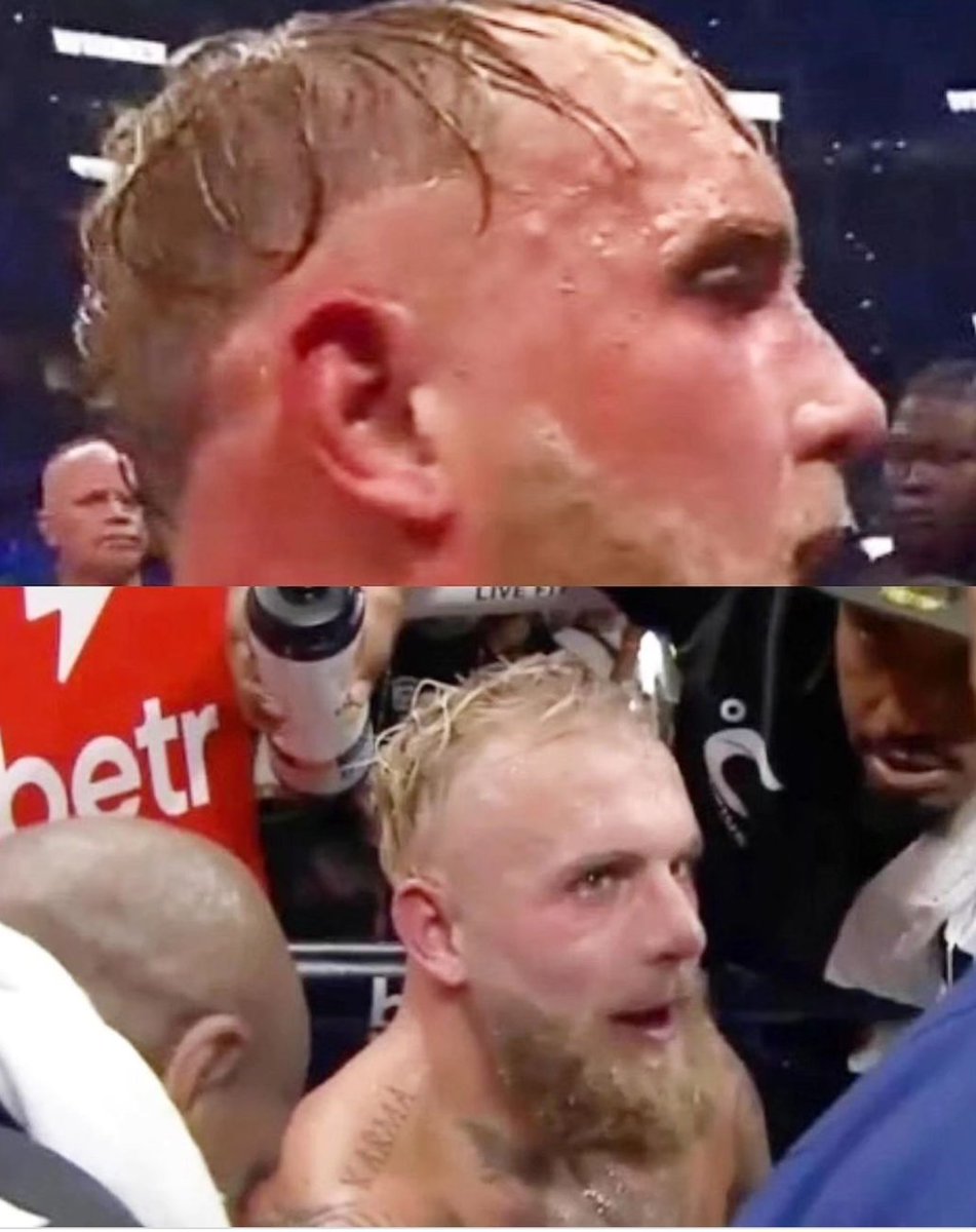 upfrontmma's tweet photo. "Hates Dana White"
"Imitates his hairstyle" 
👨‍🦲
#hairclubformen https://t.co/REy9fR8aHL