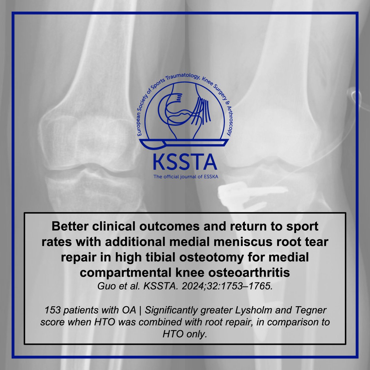 KSSTA's tweet photo. Donโt forget posterior medial meniscus root repair, in cases of HTO, as outcome might be superior, according to this new study.
#knee #OA #HTO #meniscus #rootrepair
Read here: https://t.co/VZCDMCLE5D https://t.co/j2e85wvx2f