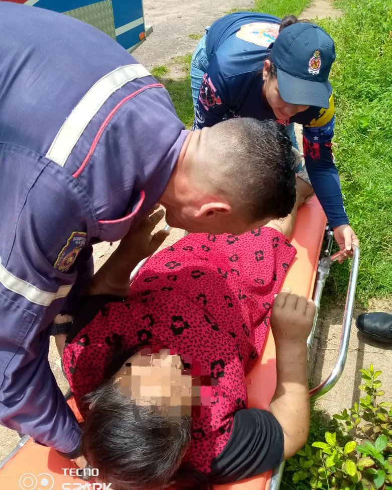 BomberosDelta22's tweet photo. 🚑#Traslado // Realizamos traslado, por presentar Edematizacion Generalizada la misma fue recibida y atendida, Desde sector Triunfo III calle Monagas hasta el CDI Simón Bolívar de Sierra Imataca municipio Casacoima. 
#21Jul 
#DisciplinaYAbnegación https://t.co/6eJW2trjrG