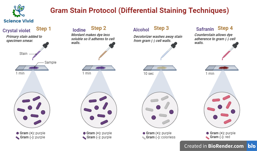 SCIENCEVIVID2's tweet photo. Staining of Microorganism: Negative Staining, Simple Staining, Differential Staining, Simple Staining, Endospore Staining, Lactophenol cotton blue mounting.
https://t.co/Jx9JPO32K3 https://t.co/6vpWgWE3w9