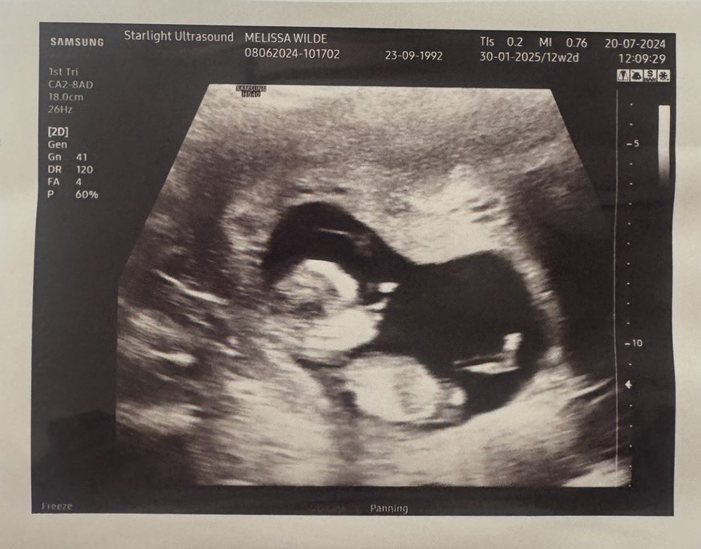 Adam Wilde tweet media