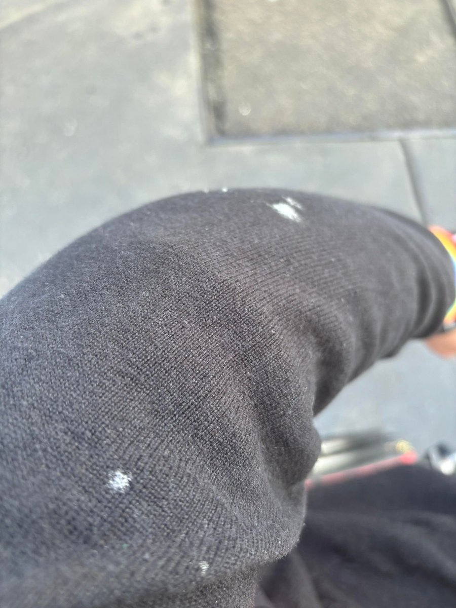 Sam Connor (@criprights) on Twitter photo Please share
Yesterday, as I went up the street in my wheelchair, a passing man looked at me, hoiked up, violently spat at me.
This has taken me this long to write.
Men spit into their hand when they rape you. It is a huge trigger for me. I fled, thinking about <a href="/BillShorten/">Bill Shorten</a>. Please share
Yesterday, as I went up the street in my wheelchair, a passing man looked at me, hoiked up, violently spat at me.
This has taken me this long to write.
Men spit into their hand when they rape you. It is a huge trigger for me. I fled, thinking about <a href="/BillShorten/">Bill Shorten</a>.