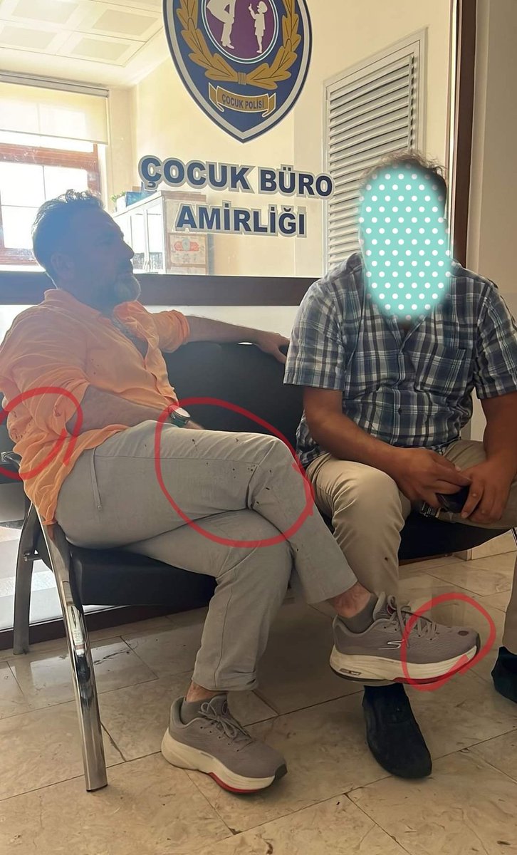 İstanbul 3.bölgeden AKP Milletvekili A.Adayı Hakan Arslantaş, sokak ortasında eski eşi ve öz kızını dövüp bıçakladıktan sonra, emniyette üstü başı kan içinde bacak bacak üstüne atıp sakince bekledi. "Ben AKP'liyim, hakimi savcıyı da satın alırım" 
dediği iddia edilen Arslantaş,