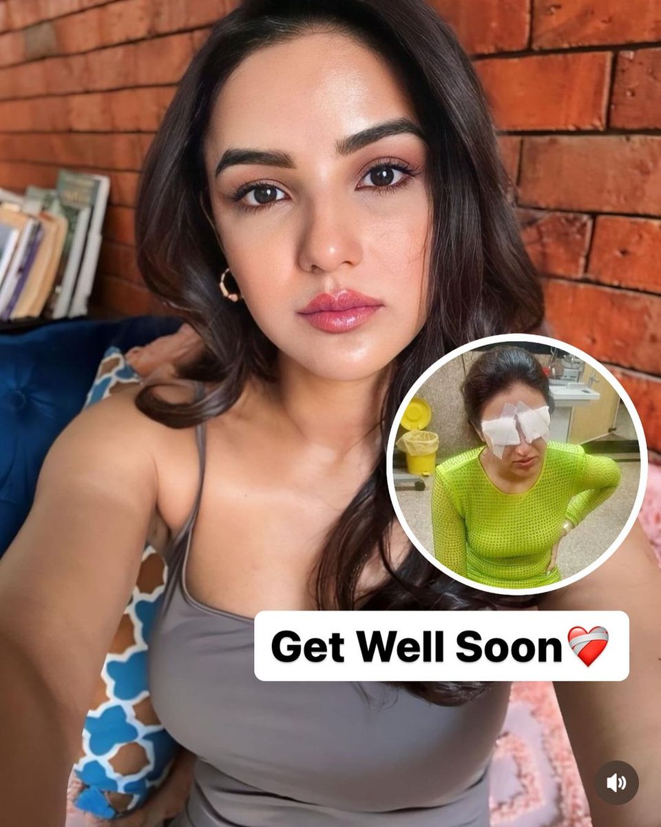 EllinaFox's tweet photo. Jasmin Bhasin, On June 17, the actress experienced a significant eye issue after wearing lenses for an event.
.
.
#jasminbhasin #issue #eye #eyeissue #lenses #event #infection #eyeinfection #getwellsoon #latest #news #latestnews #explore #explorepage #trending #viral https://t.co/XlbJr3qpkD