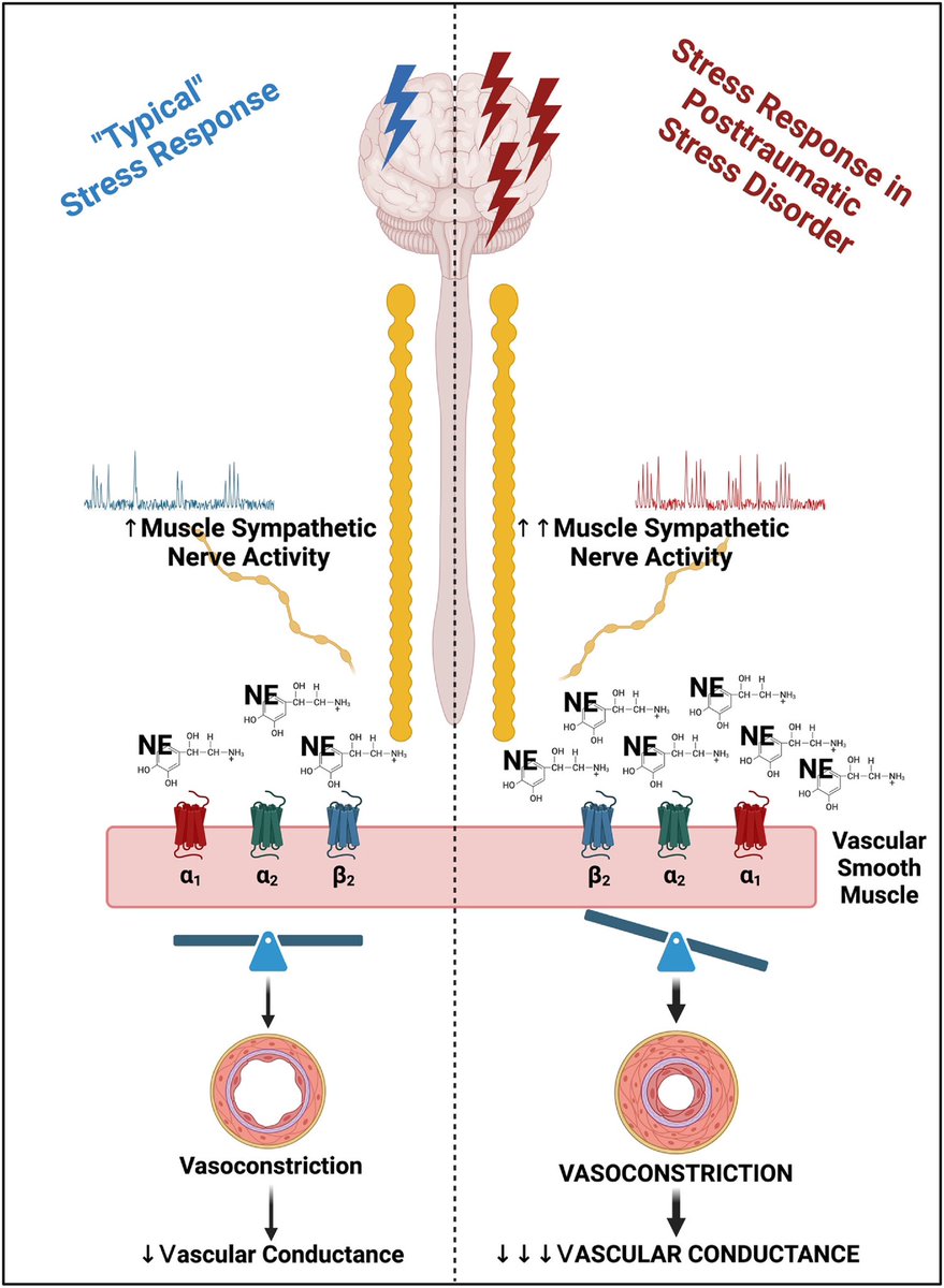 Nathaniel Jenkins, PhD, FAHA (@njenkinsphd) on Twitter photo My commentary on <a href="/ZacMartinPhD/">Zac Martin</a> et al’s paper demonstrating exaggerated vasoconstriction during trauma recall in PTSD among twins from the Vietnam Era Twin Registry now published in <a href="/BiologicalPsyc1/">Biological Psychiatry</a> @
 sciencedirect.com/science/articl…
Link to original paper here: sciencedirect.com/science/articl… My commentary on <a href="/ZacMartinPhD/">Zac Martin</a> et al’s paper demonstrating exaggerated vasoconstriction during trauma recall in PTSD among twins from the Vietnam Era Twin Registry now published in <a href="/BiologicalPsyc1/">Biological Psychiatry</a> @
 sciencedirect.com/science/articl…
Link to original paper here: sciencedirect.com/science/articl…