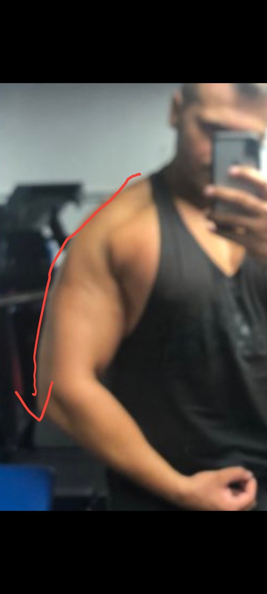 Moe_Hdy_'s tweet photo. @JBColbert12 @chatjaipt @CerfiaFR 10 années de musculations mais des deltoides toujours inexistants 🤣🤣🤣

T'es juste un gros tas de gras ftg https://t.co/5fWpzykECg