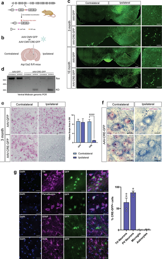 ScienceofPD's tweet photo. New research from @MooreLabVAI &amp; @VAInstitute colleagues reports adult-onset deletion (via AAV-Cre) of #Parkinsons-associated ATP13A2 (PARK9) in mice induces progressive nigrostriatal pathway dopaminergic degeneration &amp; lysosomal abnormalities
https://t.co/JQyNES2l9P https://t.co/hjLc35fEtG