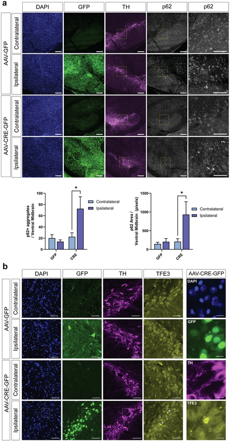 ScienceofPD's tweet photo. New research from @MooreLabVAI &amp; @VAInstitute colleagues reports adult-onset deletion (via AAV-Cre) of #Parkinsons-associated ATP13A2 (PARK9) in mice induces progressive nigrostriatal pathway dopaminergic degeneration &amp; lysosomal abnormalities
https://t.co/JQyNES2l9P https://t.co/hjLc35fEtG
