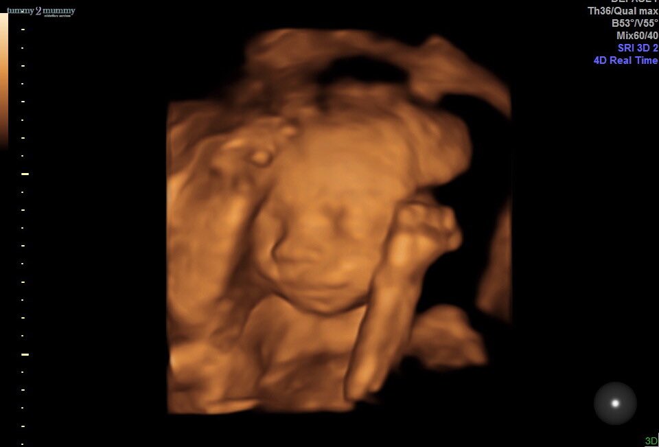 faye1414's tweet photo. Baby W - Due November 2024 ✨ 💛 https://t.co/v0yP4lJCng