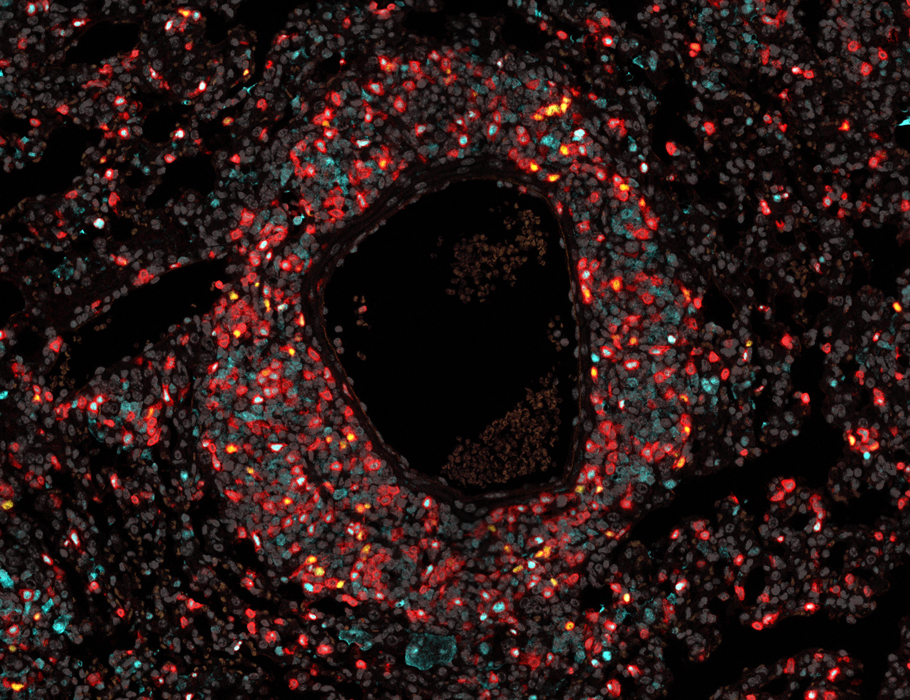 Science Immunology tweet media