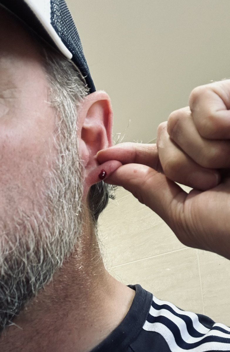 How the hell does an ear just start bleeding randomly?!