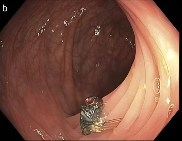 Creepy.org tweet media