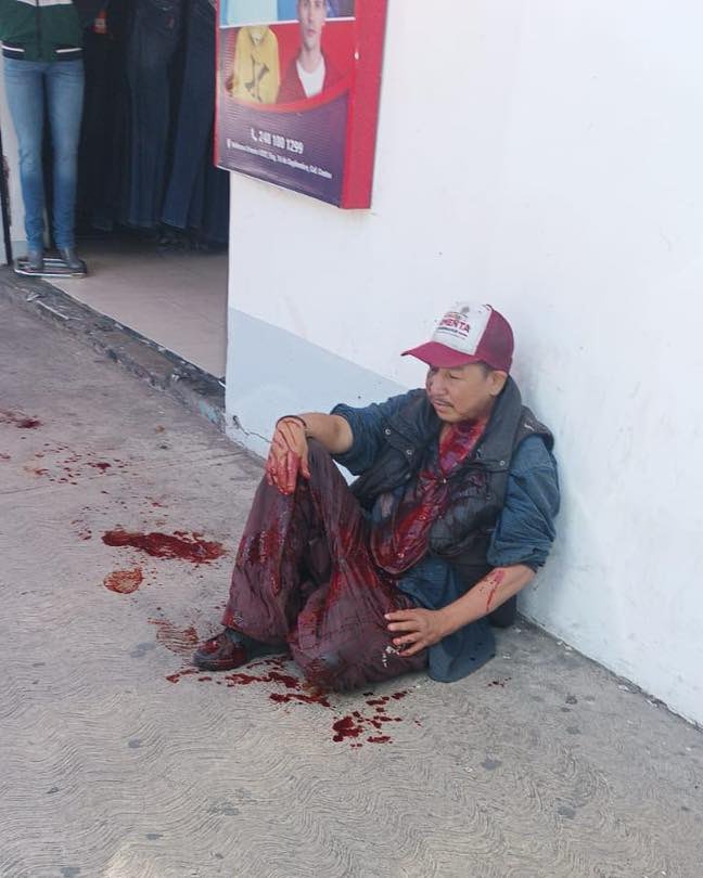 NotiPuebla94's tweet photo. #Entérate || La mañana de este domingo Usuarios a través de grupos de whatsapp reportan persona baleada en Av. Libertad a la altura del crucero en #Texmelucan.

Y una persona herida gravemente por un arma punzocortante en la C. 16 de Sep en el centro de #Texmelucan https://t.co/iqVf8Pwdi2