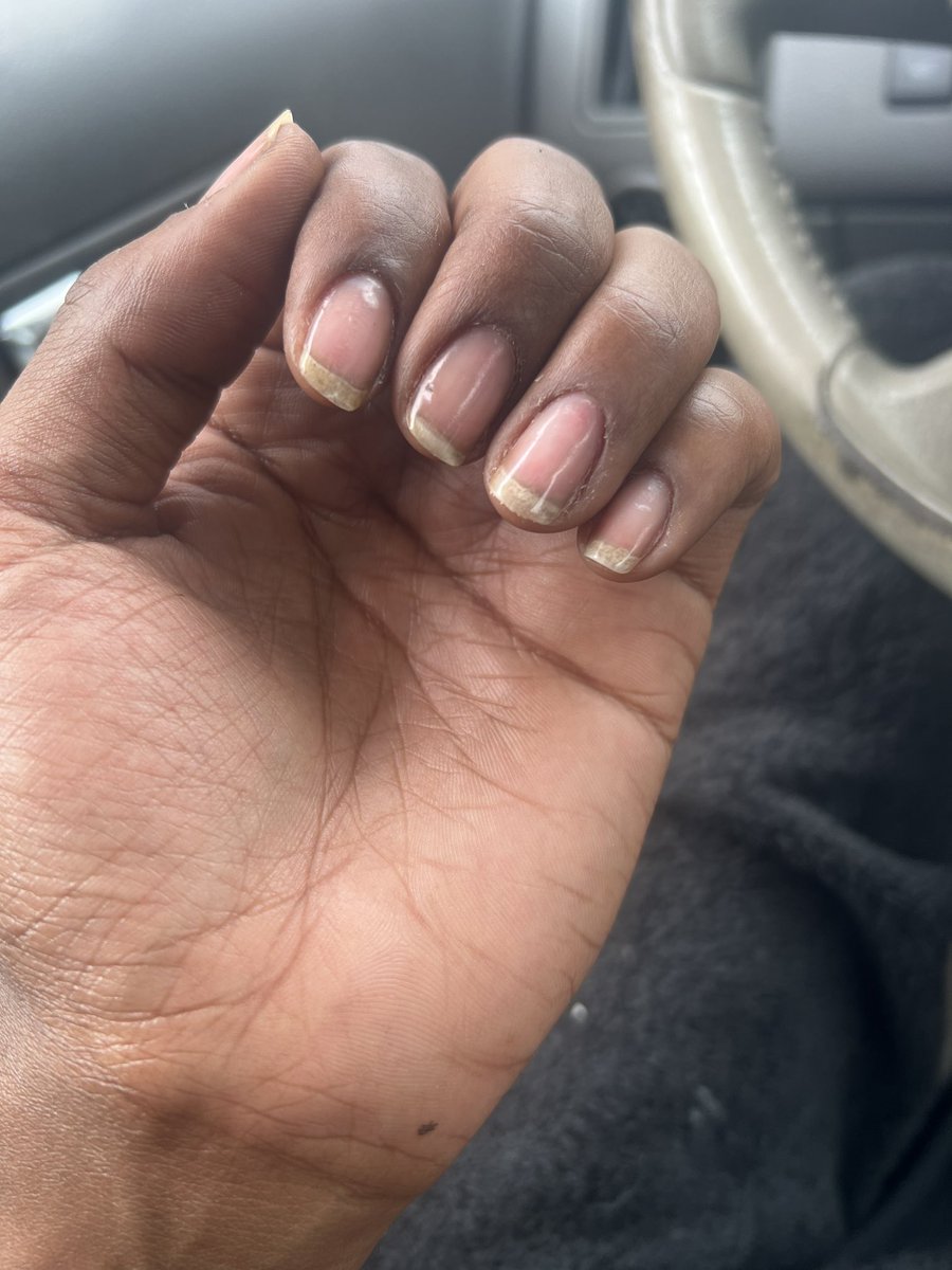stefanartistry's tweet photo. Old set off and nails prepped for the next design #nailcontent https://t.co/zFA2l8B7WE