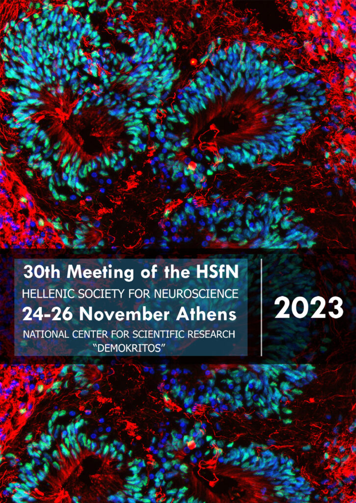 WRITE project (@writeproject2) on Twitter photo <a href="/WRITEproject2/">WRITE project</a> team had the pleasure to present multiple aspects of our work in progress at the 30th meeting of the Hellenic Society for Neuroscience, #neuroscience #conference #laterality <a href="/WRITEproject2/">WRITE project</a> team had the pleasure to present multiple aspects of our work in progress at the 30th meeting of the Hellenic Society for Neuroscience, #neuroscience #conference #laterality