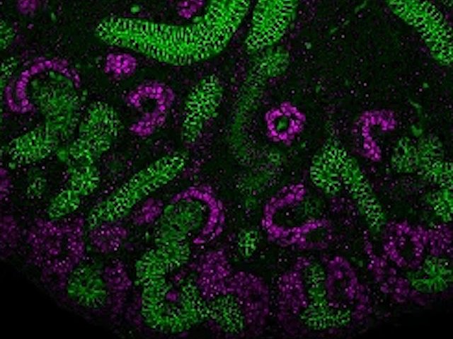 Biomedical Picture of the Day BPoD (@bpod_s) on Twitter photo Impact of #epigenetic regulator ENL – mutated in childhood #kidney #cancer #Wilmstumour – on developing kidney's gene regulatory landscape before & after birth. Image & research by Lele Song & Qinglan Li et al <a href="/LilingWanLab/">Liling Wan</a> @UPenn in <a href="/NatureComms/">Nature Communications</a>. On bpod.org.uk/archive/2024/7… Impact of #epigenetic regulator ENL – mutated in childhood #kidney #cancer #Wilmstumour – on developing kidney's gene regulatory landscape before & after birth. Image & research by Lele Song & Qinglan Li et al <a href="/LilingWanLab/">Liling Wan</a> @UPenn in <a href="/NatureComms/">Nature Communications</a>. On bpod.org.uk/archive/2024/7…