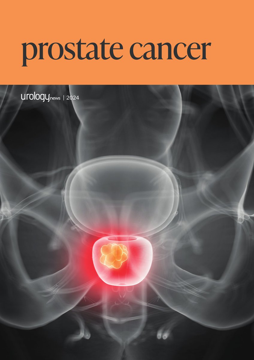 KebomedUKUro (@kebomedukuro) on Twitter photo <a href="/KebomedUK/">Kebomed UK</a> is proud to support the recent <a href="/Uro_News/">Urology News</a> supplement from leading experts and innovators in prostate Cx
➡ prostate cancer diagnosis
➡ focal therapy solutions
➡ Active surveillance
➡ Prostate cancer screening
<a href="/KoelisBx/">KOELIS</a>
bit.ly/4a0XiBx <a href="/KebomedUK/">Kebomed UK</a> is proud to support the recent <a href="/Uro_News/">Urology News</a> supplement from leading experts and innovators in prostate Cx
➡ prostate cancer diagnosis
➡ focal therapy solutions
➡ Active surveillance
➡ Prostate cancer screening
<a href="/KoelisBx/">KOELIS</a>
bit.ly/4a0XiBx