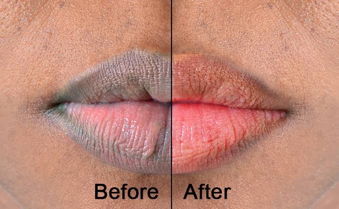#NaijaFarmerTips 

Having a pink lips is so attractive but is it really worth the money spent on creams or even surgery these days?

Are you looking to have pink lips on a lean budget? 

Try this:

- Massage your lips with a mixture of almond oil and lemon juice just before you