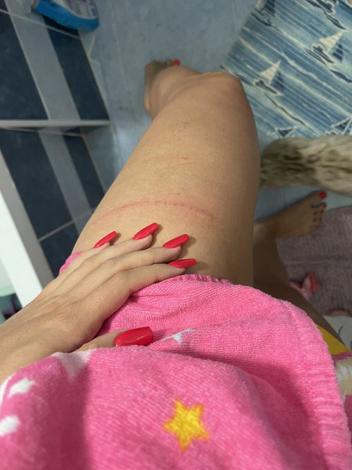 Ouch!! 😭😭😭 https://t.co/kj2n9UmVnY