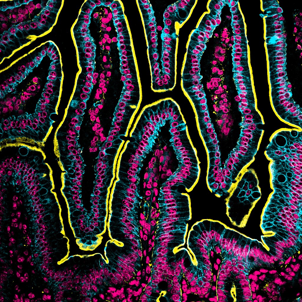 Happy #MicroscopyMonday!

#sciart #pathart #histoart #intestine #microscopy
