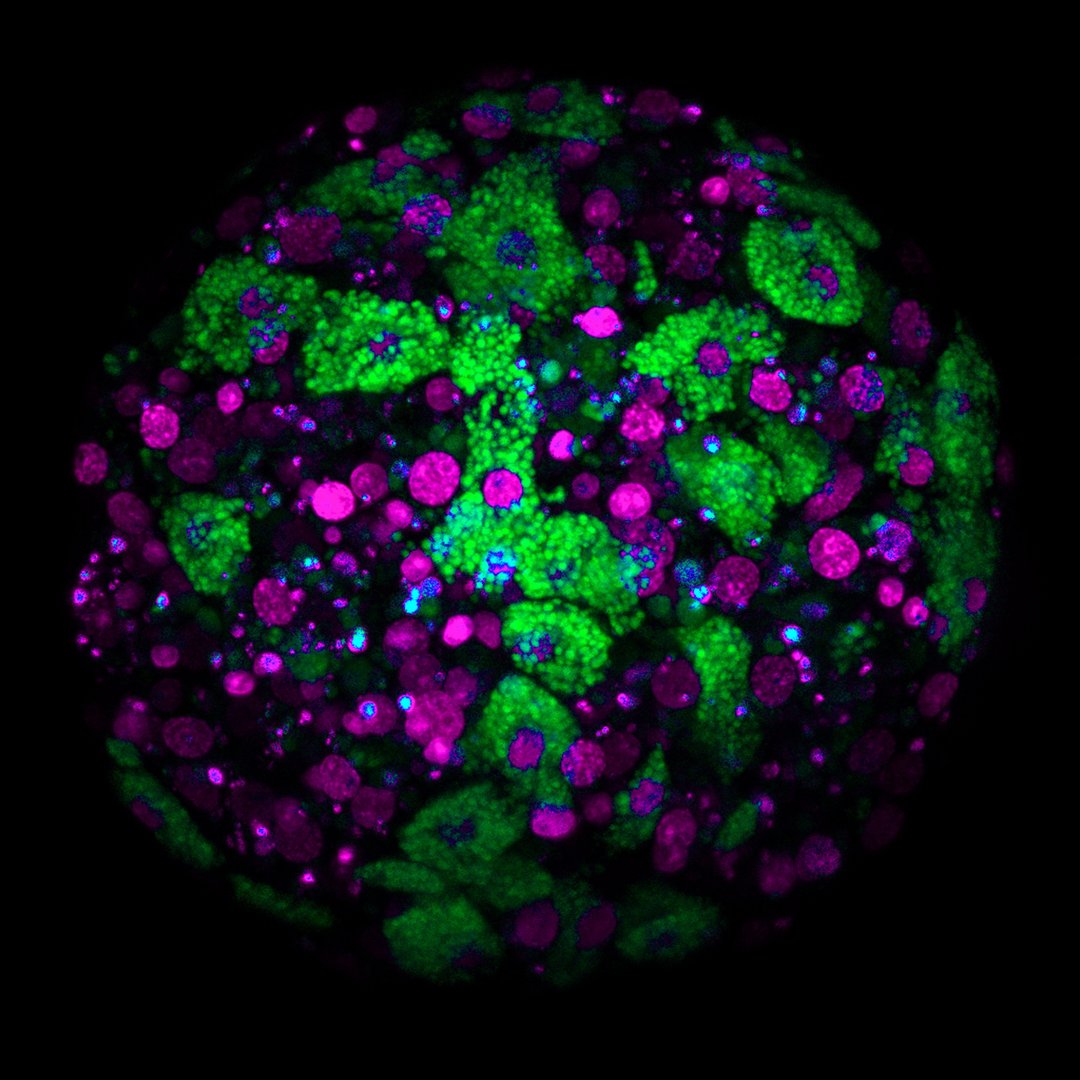 It's #MicroscopyMonday, let's go take a look into the 🔬!

10 hours post-dissociation aggregate of cells of the marine sponge, Clathria prolifera. 

Credit: Shun Sogabe
 (The University of Queensland, Australia)