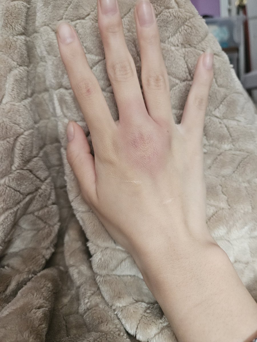 NakeiLu's tweet photo. I may or may not have broke a knuckle https://t.co/bKVJ0VM0BM
