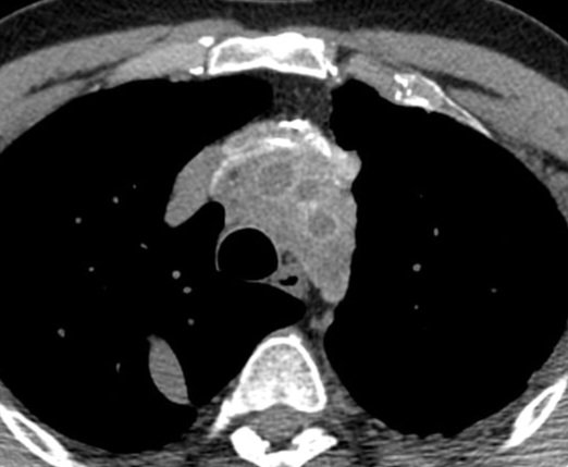 Matheus Zanon, MD, MSc tweet media