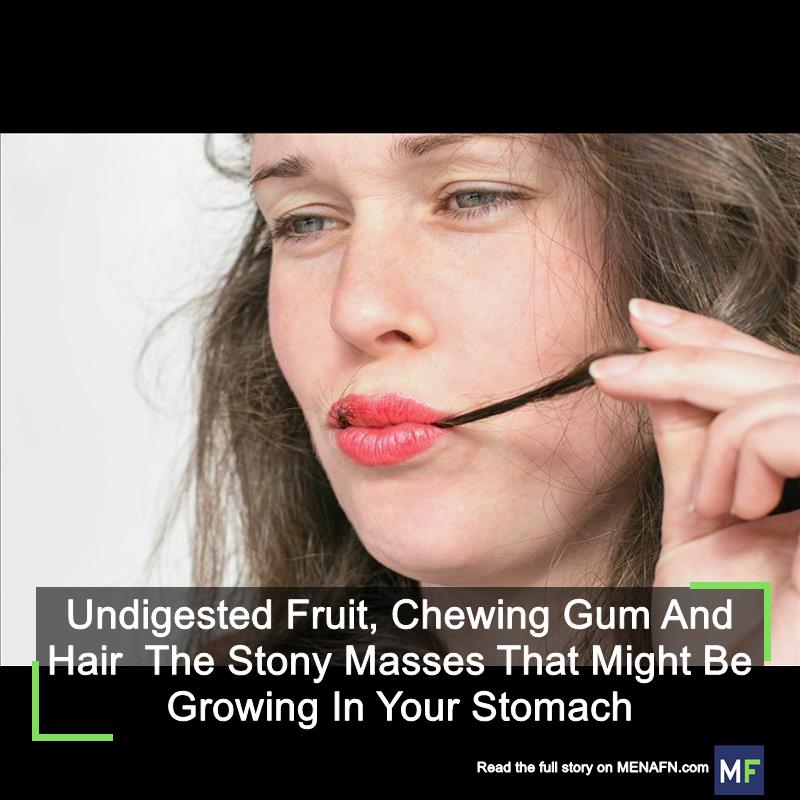 MENAFN's tweet image. Undigested Fruit, Chewing Gum And Hair The Stony Masses That Might Be Growing In Your Stomach #Undigested #Fruit, #Chewing #Hair #Stony #Masses #That #Might #Growing #Your #Stomach #School #University #Collage #Teach #Student dlvr.it/T9wvSM