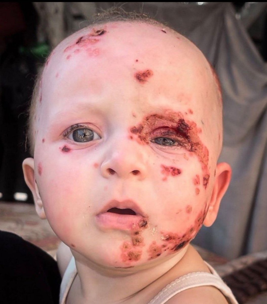 ShaykhSulaiman's tweet photo. THIS IS JUST A BABY

ISRAEL DID THIS https://t.co/5tk2L8Ij7R