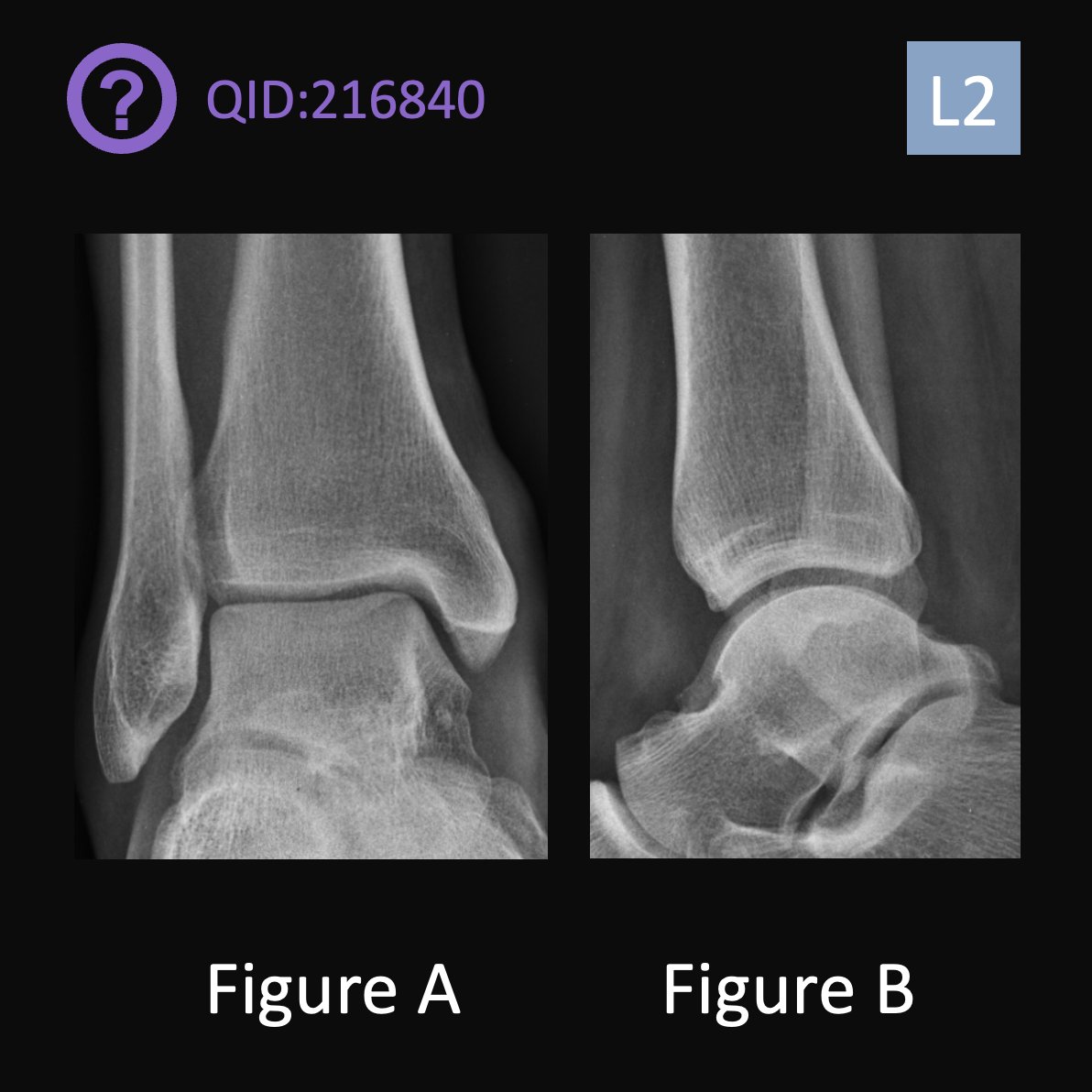 orthobullets's tweet photo. Can you answer this daily question from our Free QBank correctly? 

QID: 216840
Comment your answer below, then check to see if you got it correct by clicking the link below to see the answer &amp; explanation.
https://t.co/Ph2jTFTQqK
#orthotwitter #MedTwitter https://t.co/fKbkPElkNN