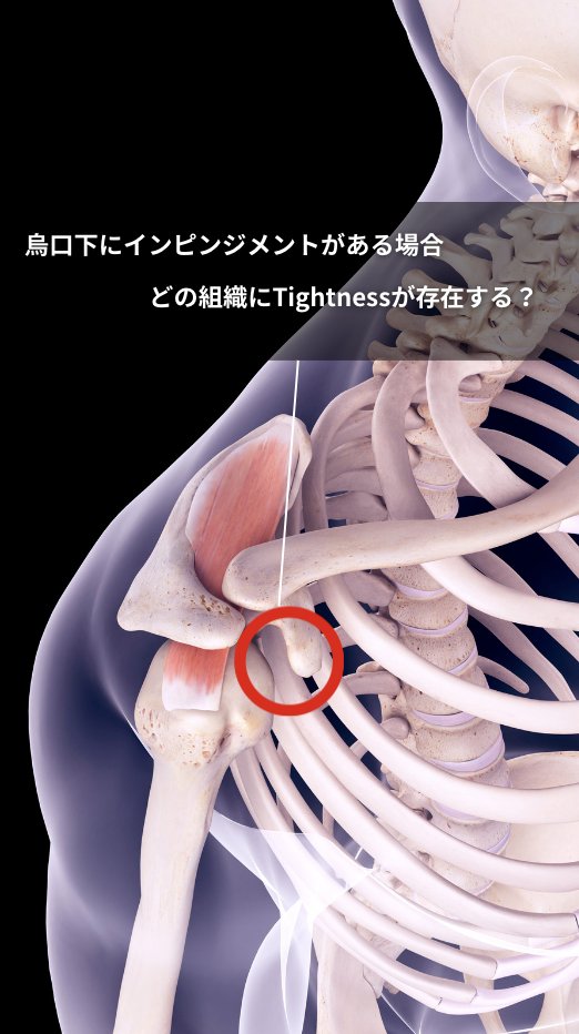 realize_lab's tweet photo. 🚩インピンジメントの要因特定

今日のInstagramの内容です...
I
テーマは
＜肩峰下インピンジメント＞
I
I
2000文字のコラムがありますので、
この投稿見失わない様にしておいてください☺️
🔻
https://t.co/S3NjWz5ibt https://t.co/TgSBBcbDIx