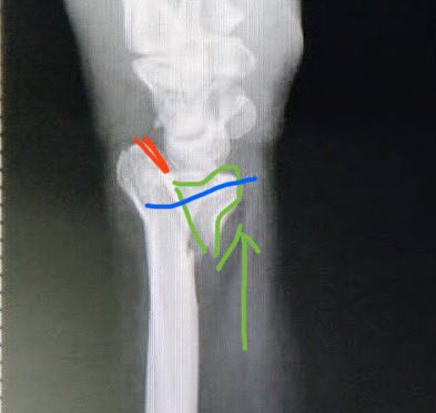 Dr. Bhavin Jadav tweet media