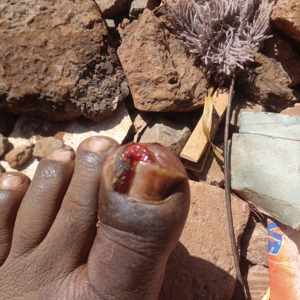 If you experienced this pain, please repost 🔁