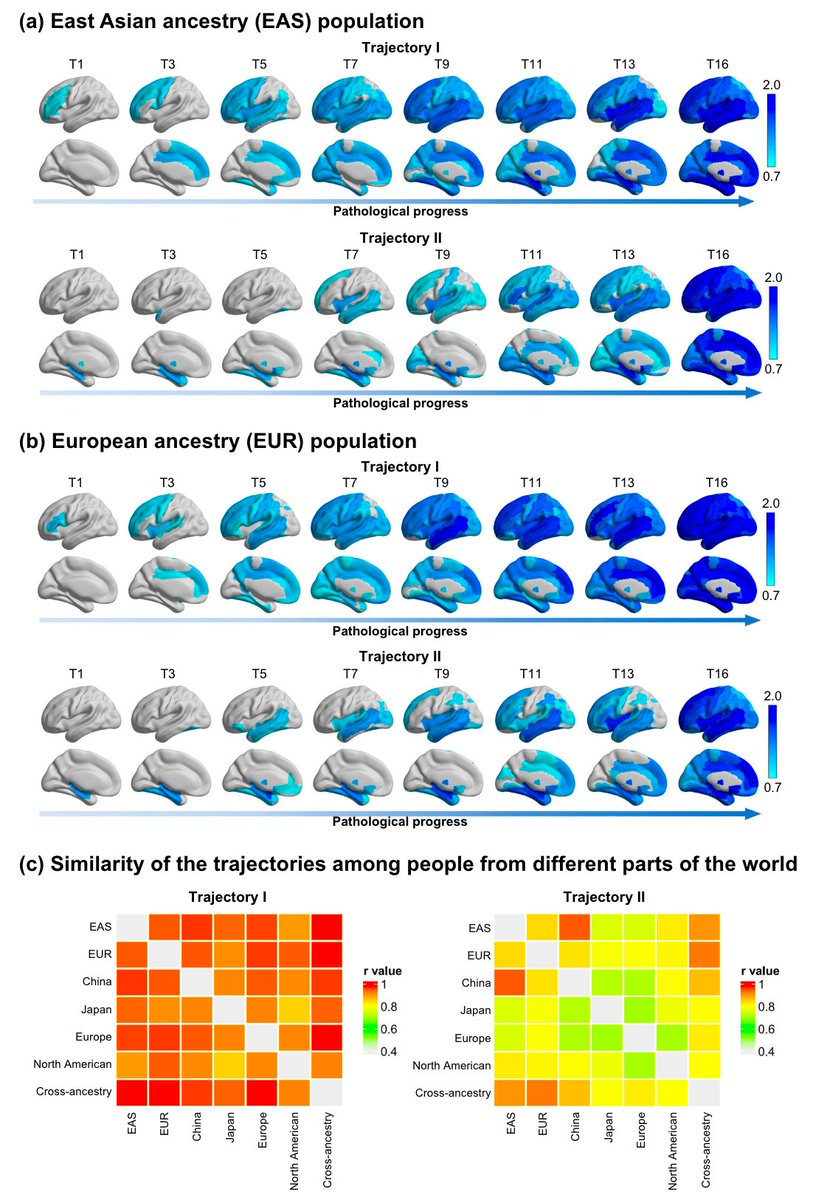 PTenigma's tweet photo. Brilliant Schizophrenia Sub-typing paper in 41 international cohorts (N=11369 MRI scans) by the Chinese ZIB Consortium + ENIGMA: https://t.co/aE2BKkKcVO
1⃣schizophrenia has (at least) 2 main subtypes with a frontal-first or temporal-first progression sequence of gray matter loss [1]
2⃣ trajectories are somewhat consistently found in Asian and European ancestry populations, especially the frontal first pattern
[1] We used to [2] think of this as a temporal->frontal sequence ( https://t.co/jKQP2ZNsgC ) but now it seems to be a mix of trajectories
[2] paper from long ago (2008!): https://t.co/c3iOFXamtC
Congrats to Wei Cheng  lab 
@Fudan Jianfeng Feng + lead author Yuchao Jiang
- https://t.co/1A02zQC1Wq pictured here: https://t.co/6FN6AkCY34