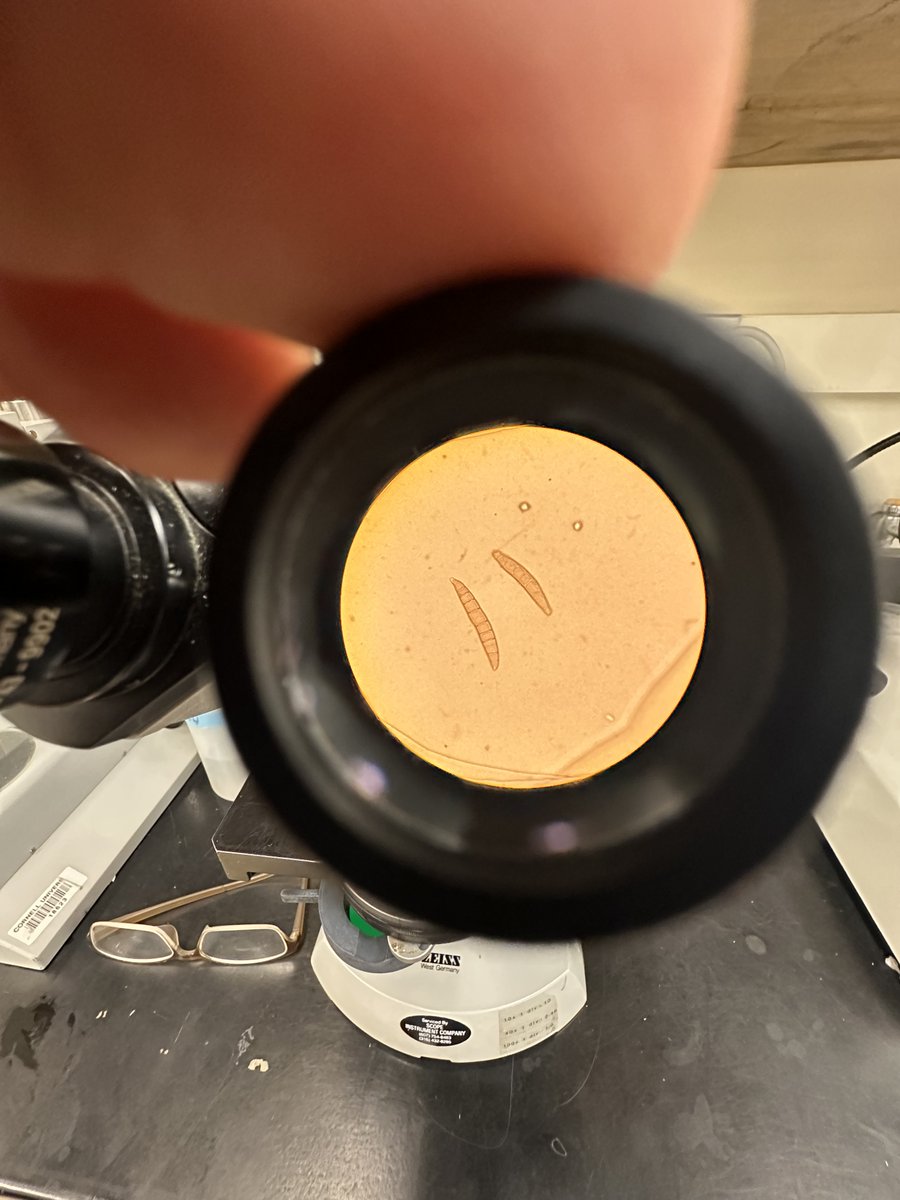 jmkolkman's tweet photo. Confirming spot blotch in barley through spore identification.  #iphonephotography and a good dose of patience. https://t.co/CvAKjjkrlI